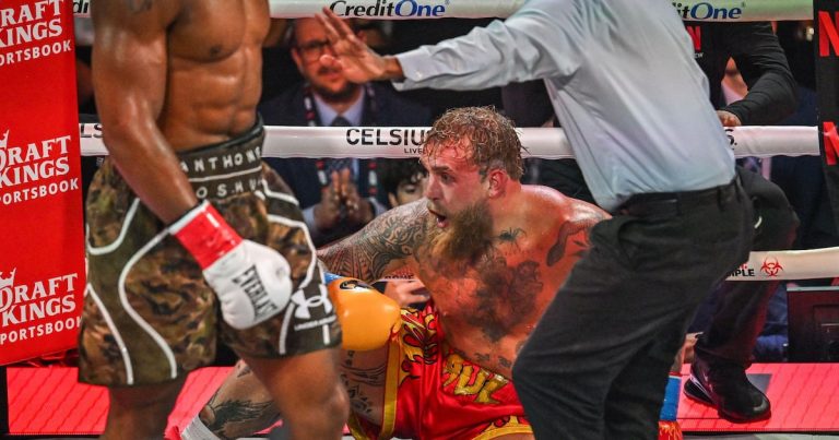 Jake Paul atualiza situação após cirurgia: ‘Placas de titânio e alguns dentes removidos’