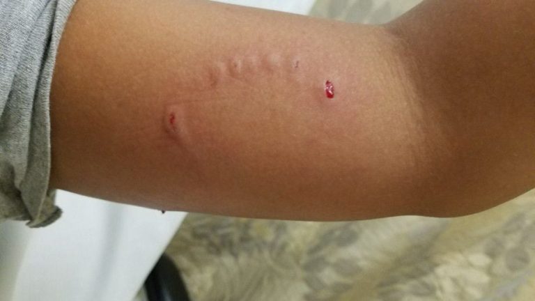 Após caso suspeito, CRMV-PB alerta para riscos da raiva e contato com animais silvestres